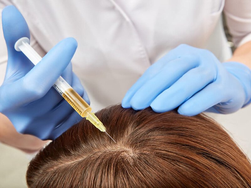 PRP & LED Hair Regrowth | Hair Transplant Clinics Australia